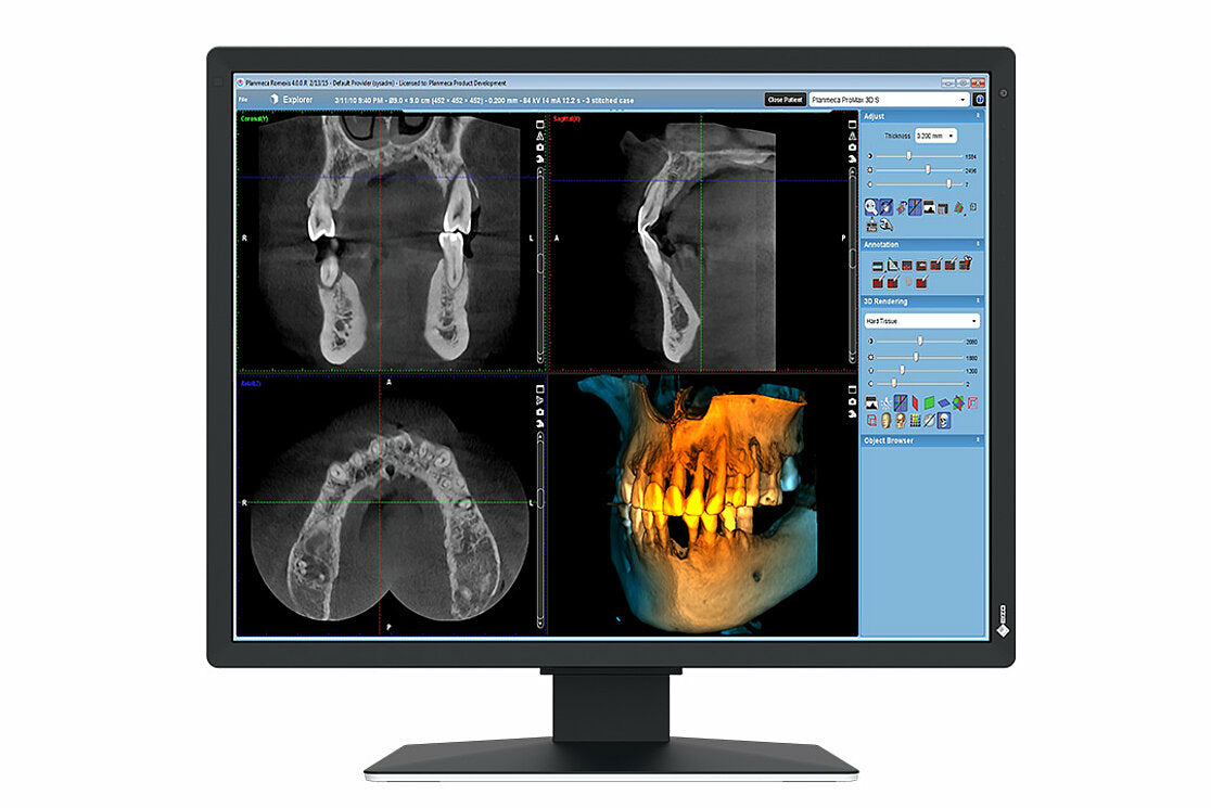 EIZO RadiForce MX217-SB Écran LCD 21" UXGA 1200 x 1600 pixels Noir