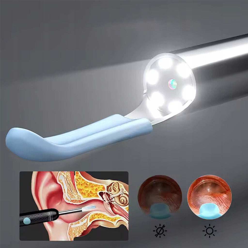 Endoscope, otoscope, appareil de nettoyage des oreilles, cire, caméra WiFi SMART Zenwire Y24