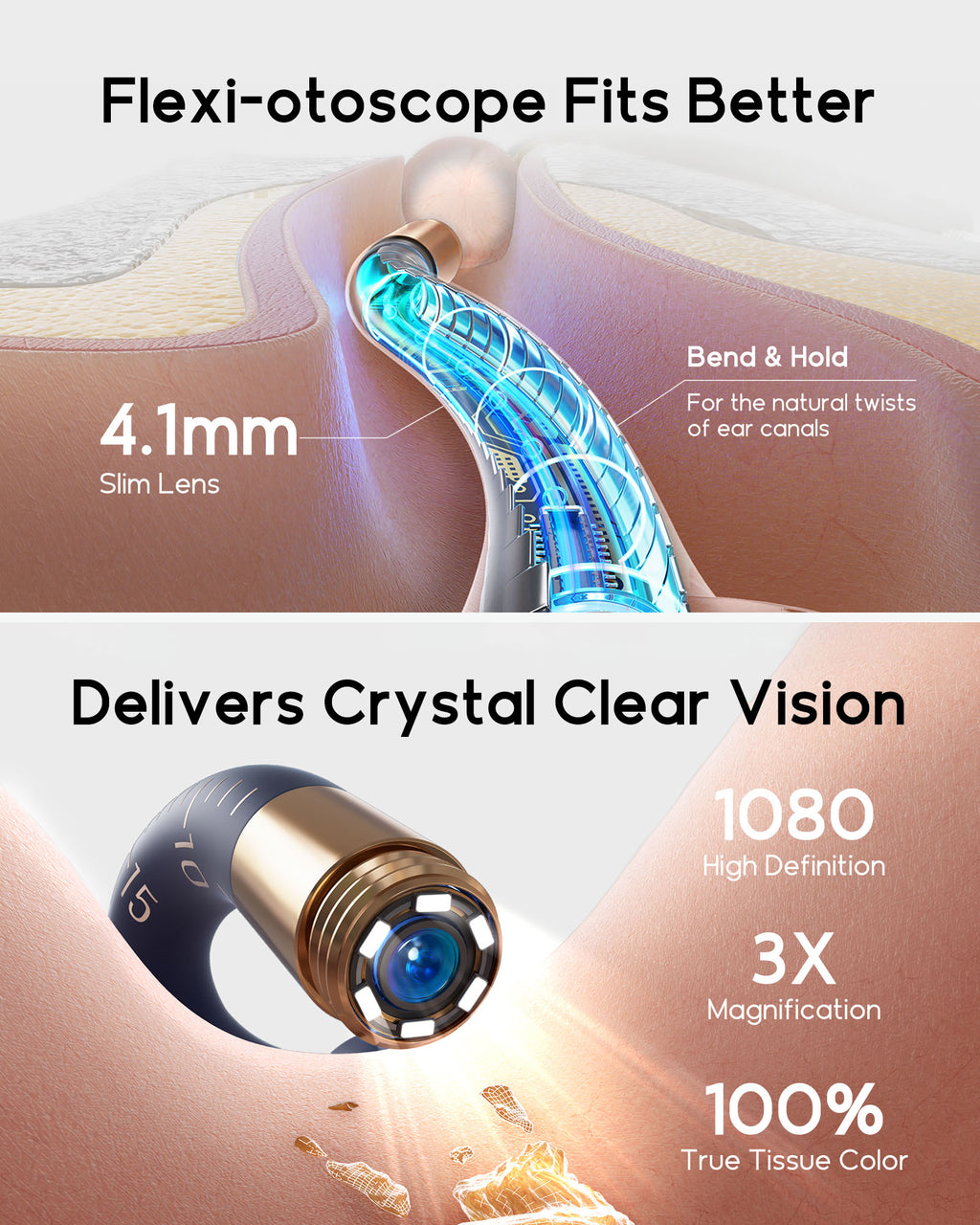 bebird Kit otoscope de nettoyage des oreilles avec caméra FHD flexible et pinces, pour examen des oreilles, du nez et de la gorge, embouts variés pour adultes et enfants