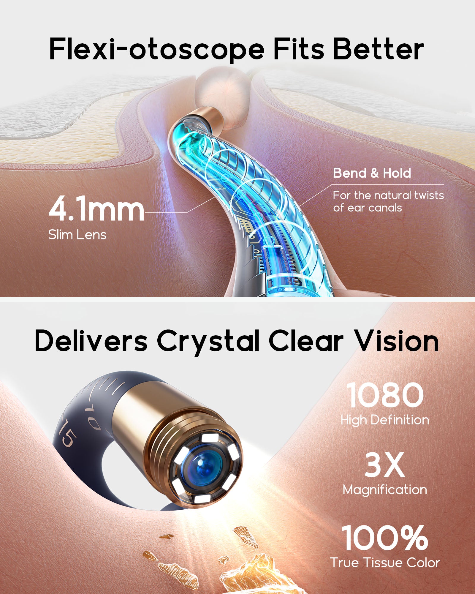 bebird Kit otoscope de nettoyage des oreilles avec caméra FHD flexible et pinces, pour examen des oreilles, du nez et de la gorge, embouts variés pour adultes et enfants