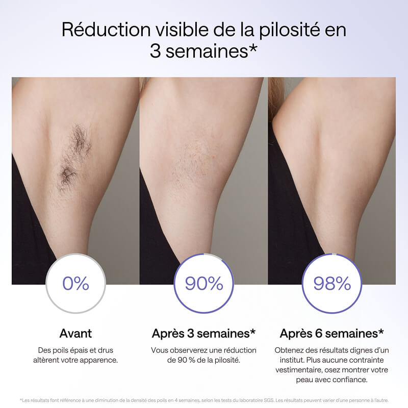 Ulike Air 3 appareil d’épilation à lumière pulsée (IPL) pour le visage et le corps, à utiliser à domicile, alternative à l’épilation au laser