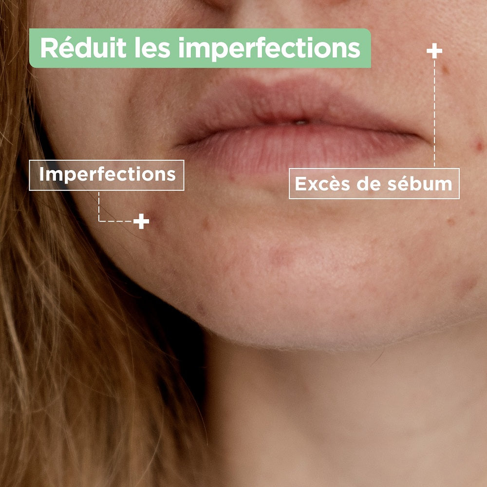 Mixa Lab Nettoyant Confort Anti-imperfections à l’Acide Salicylique 150ml
