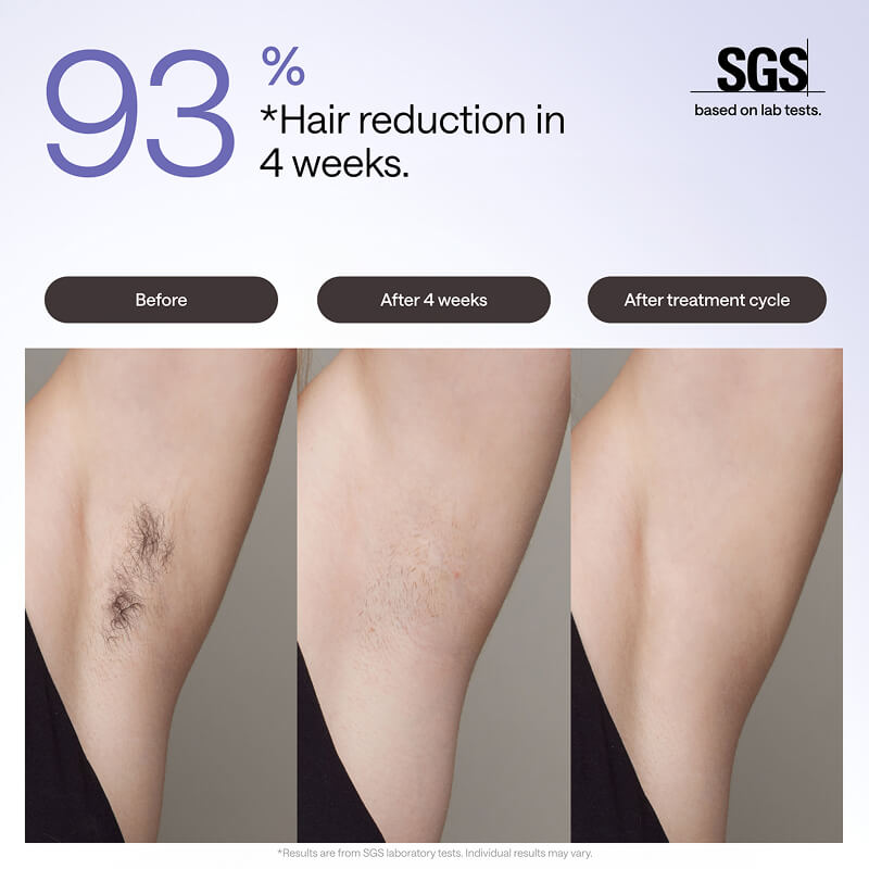 Ulike Air 3 Appareil d’épilation à lumière pulsée intense pour visage et corps à domicile, Alternative à l’épilation laser, Système de refroidissement glacé au saphir pour résultats indolores durables, Blanc