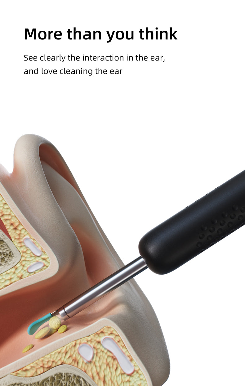 bebird SL11 Nettoyeur d’oreilles avec otoscope compatible WiFi, iPhone, iPad et Android - Blanc