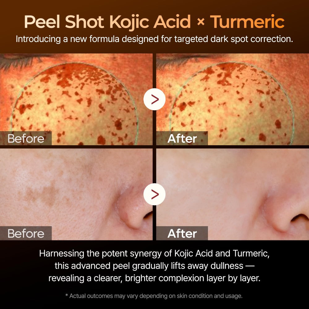 Dr. Melaxin Peel Shot Sérum Exfoliant Acide Kojique Curcuma 80 ml
