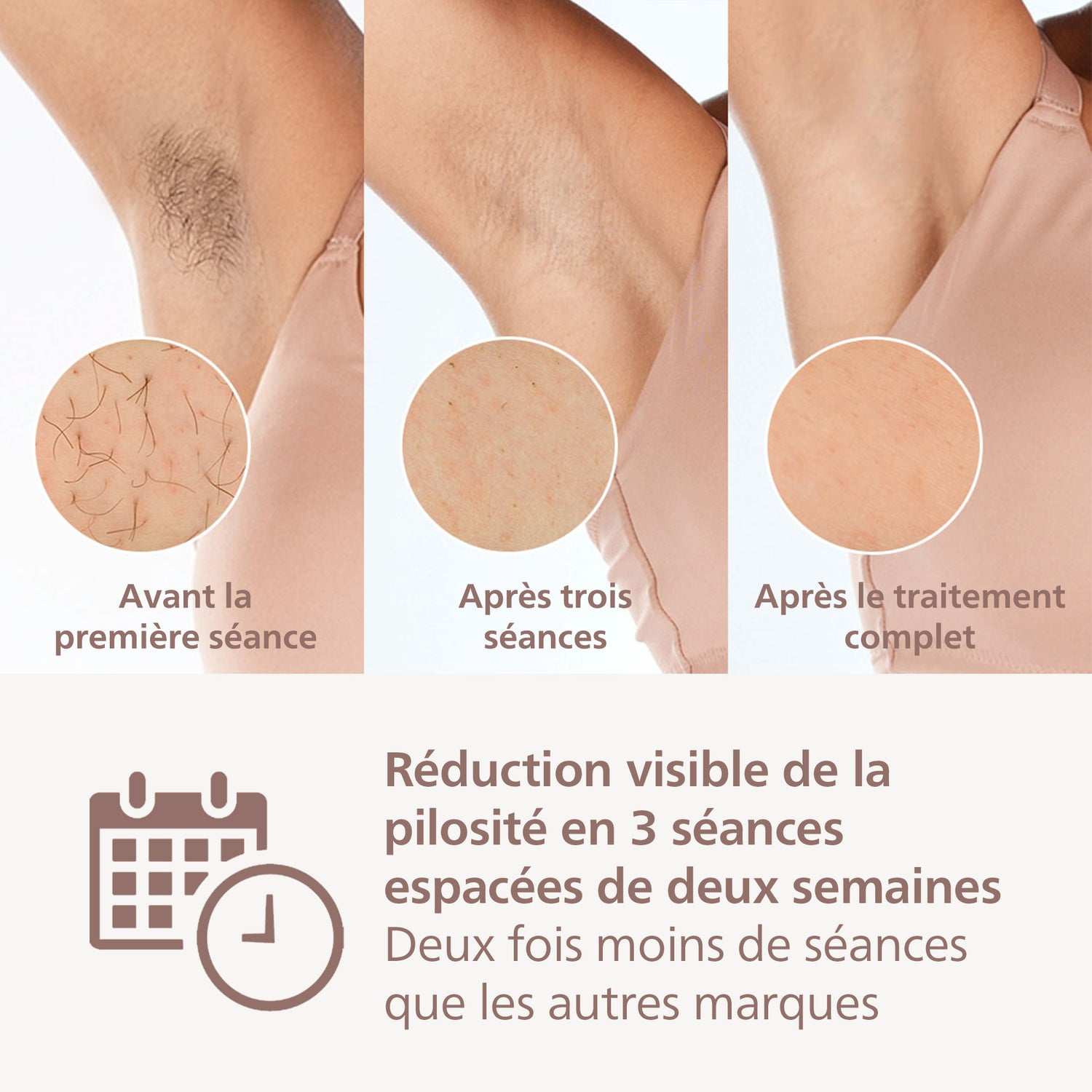 Philips Lumea Series 8000 BRI940/00 Épilateur à lumière pulsée capteur SmartSkin, 5 niveaux d'intensité, 1 accessoire intelligent corps (4,1 cm²), application Lumea IPL, sur secteur - Blanc