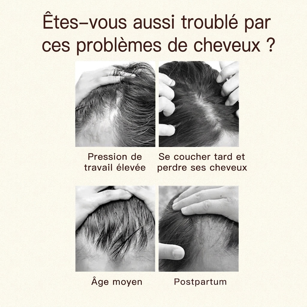 K·SKIN KD3806 Peigne de massage du cuir chevelu/Peigne nourrissant pour le cuir chevelu, Microcourant EMS + Quadruple Luminothérapie LED + Conception d'infusion de stockage de liquide