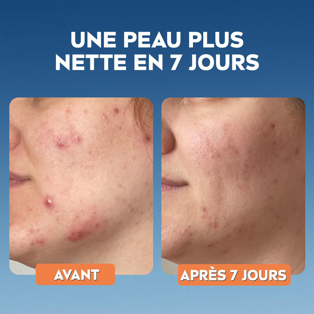 NIVEA Derma Skin Clear Gommage Exfoliant Visage anti-imperfections 150 ml
