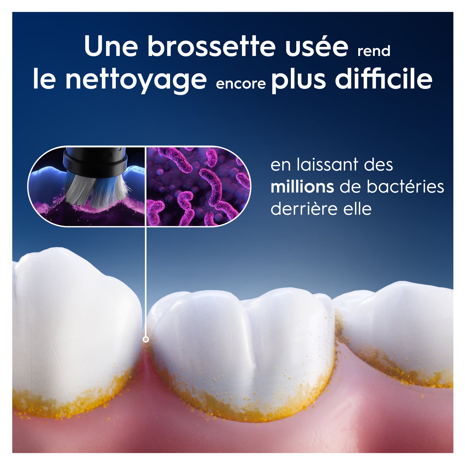 Oral-B iO Pack de 3 Brossettes de Rechange Gentle Care Blanches, Brossage Le Plus Doux, Conviennent Aux Gencives Sensibles, Brossette Pour Les Brosses A Dents Electriques Oral B iO