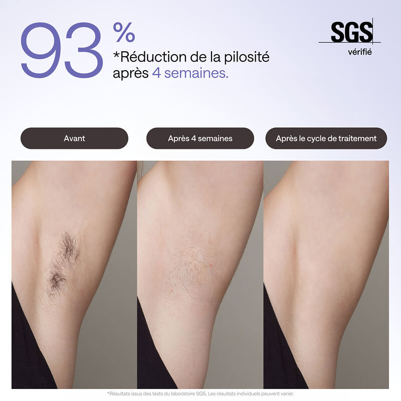Ulike Air 3 appareil d’épilation à lumière pulsée (IPL) pour le visage et le corps, à utiliser à domicile, alternative à l’épilation au laser, avec système de refroidissement Sapphire Ice pour des résultats indolores et durables, violet foncé