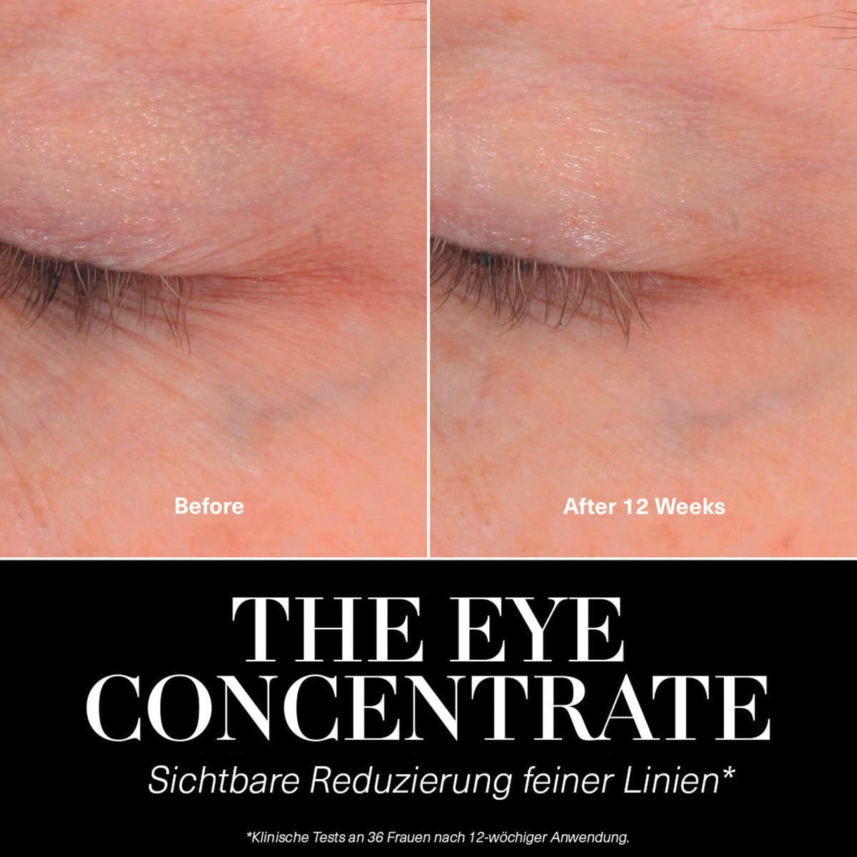 La Mer Le concentré contour des yeux - 15 ml