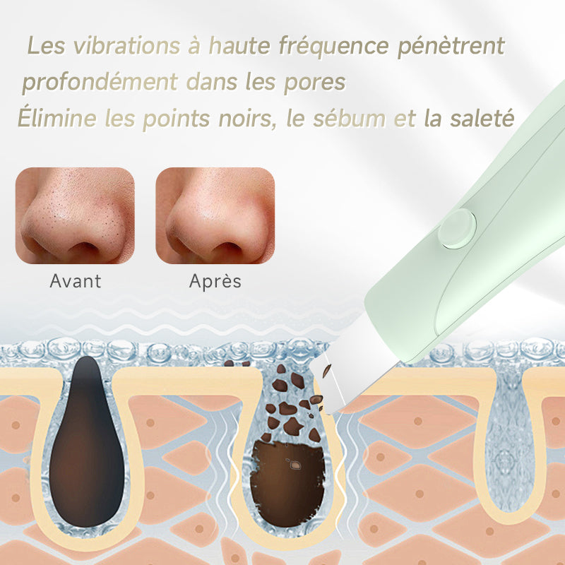 Qiweiny Appareil 2-en-1 extracteur de points noirs & grattoir visage vert