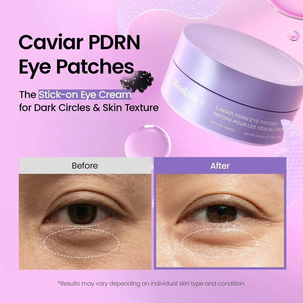 Biodance Patchs Yeux Caviar PDRN 30 Pièces/85 g