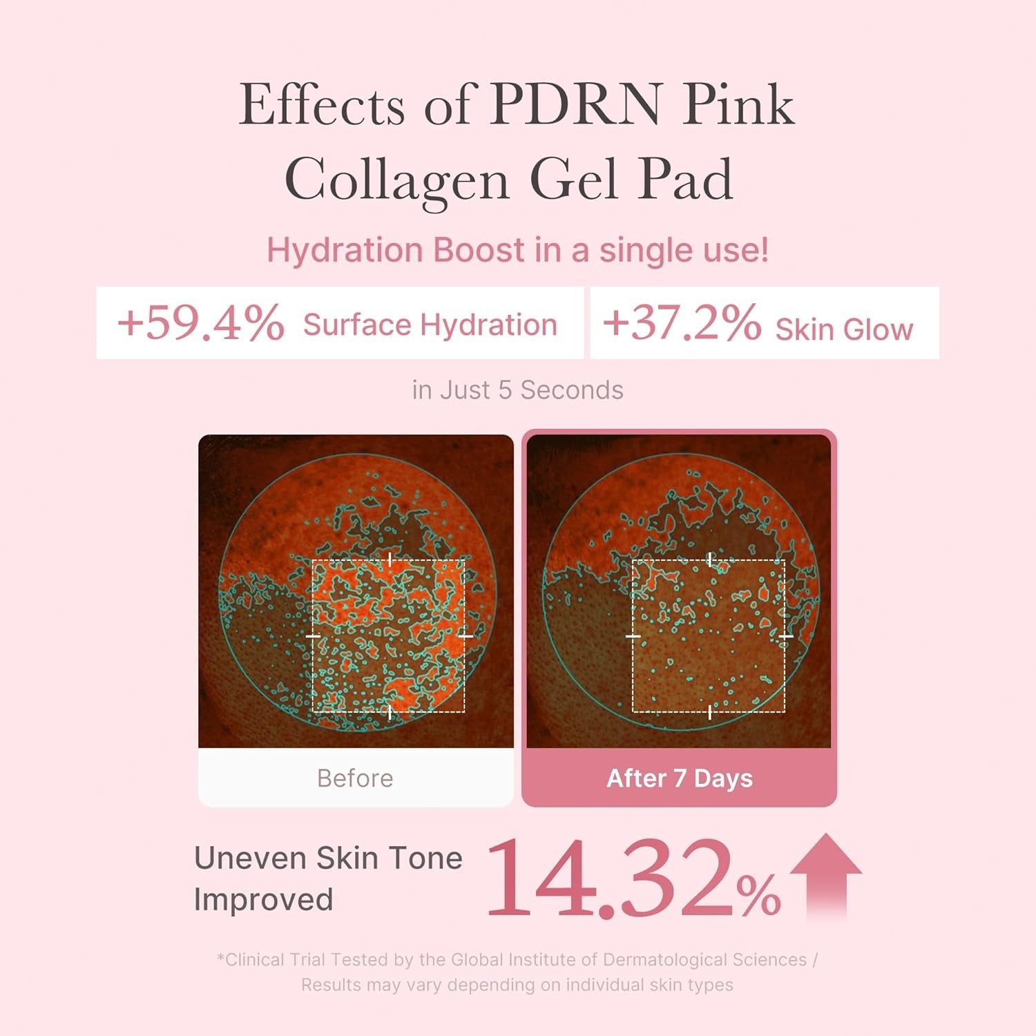 Medicube Pads de tonique en gel au collagène rose PDRN (70 pièces)