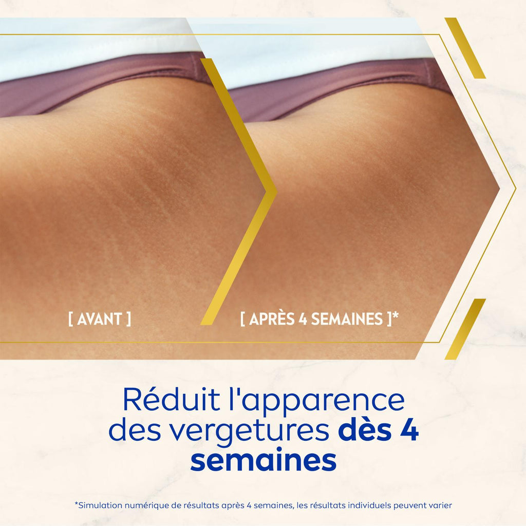 NIVEA Luminous 630 Soin corps anti-cellulite et vergetures 200 ml