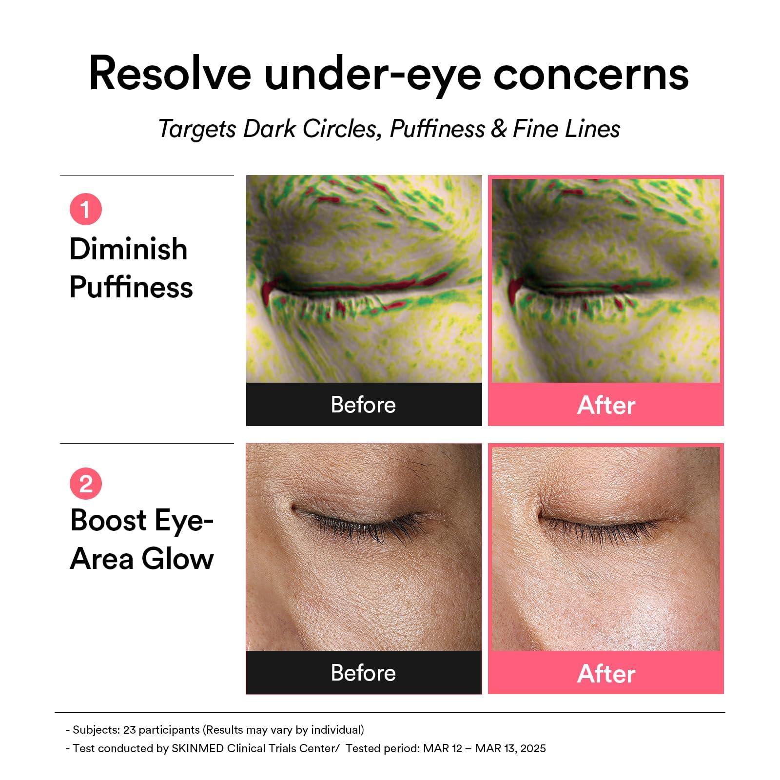 Abib patchs yeux gelée pdrn et rétinal 60 pièces (84g)