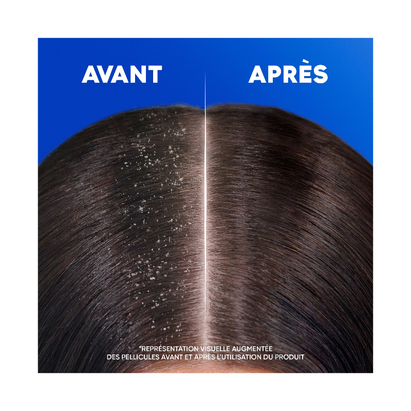 HEAD&SHOULDERS - Shampooing classique - 330 ml