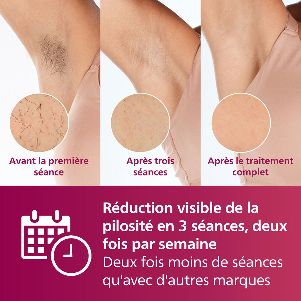 Philips Lumea Series 7000 BRI921/00 Épilateur à lumière pulsée avec capteur de teinte de peau, flashs rapides, embouts corps et visage, épilation semi définitive à domicile