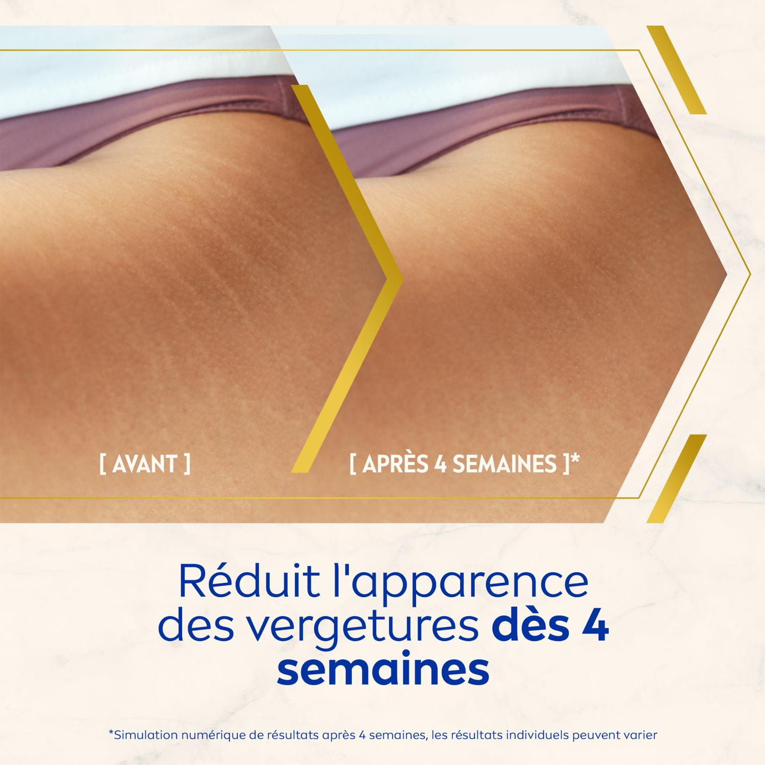 NIVEA Luminous630 Huile-sérum corps anticellulite 100 ml