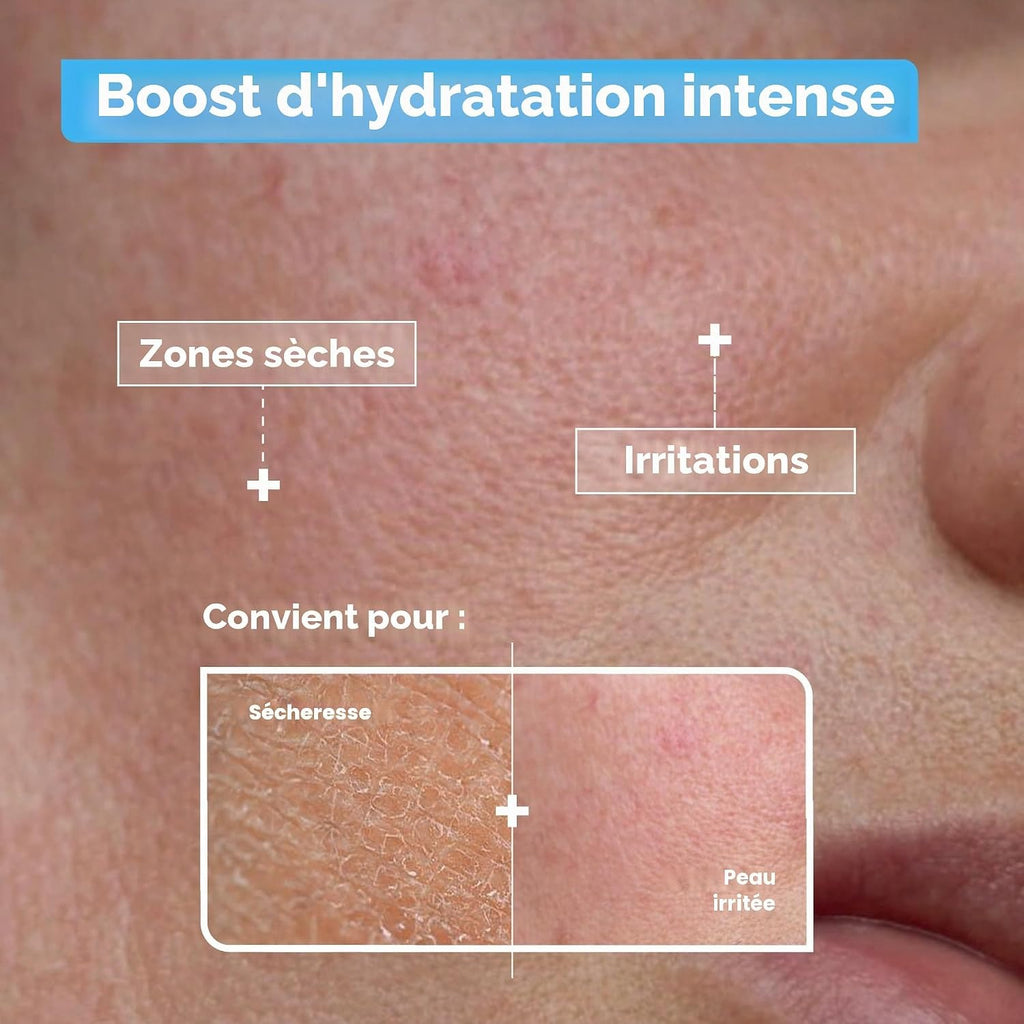 Mixa Sérum Concentré Hydratant Acide Hyaluronique et Acide Lactique 30 ml