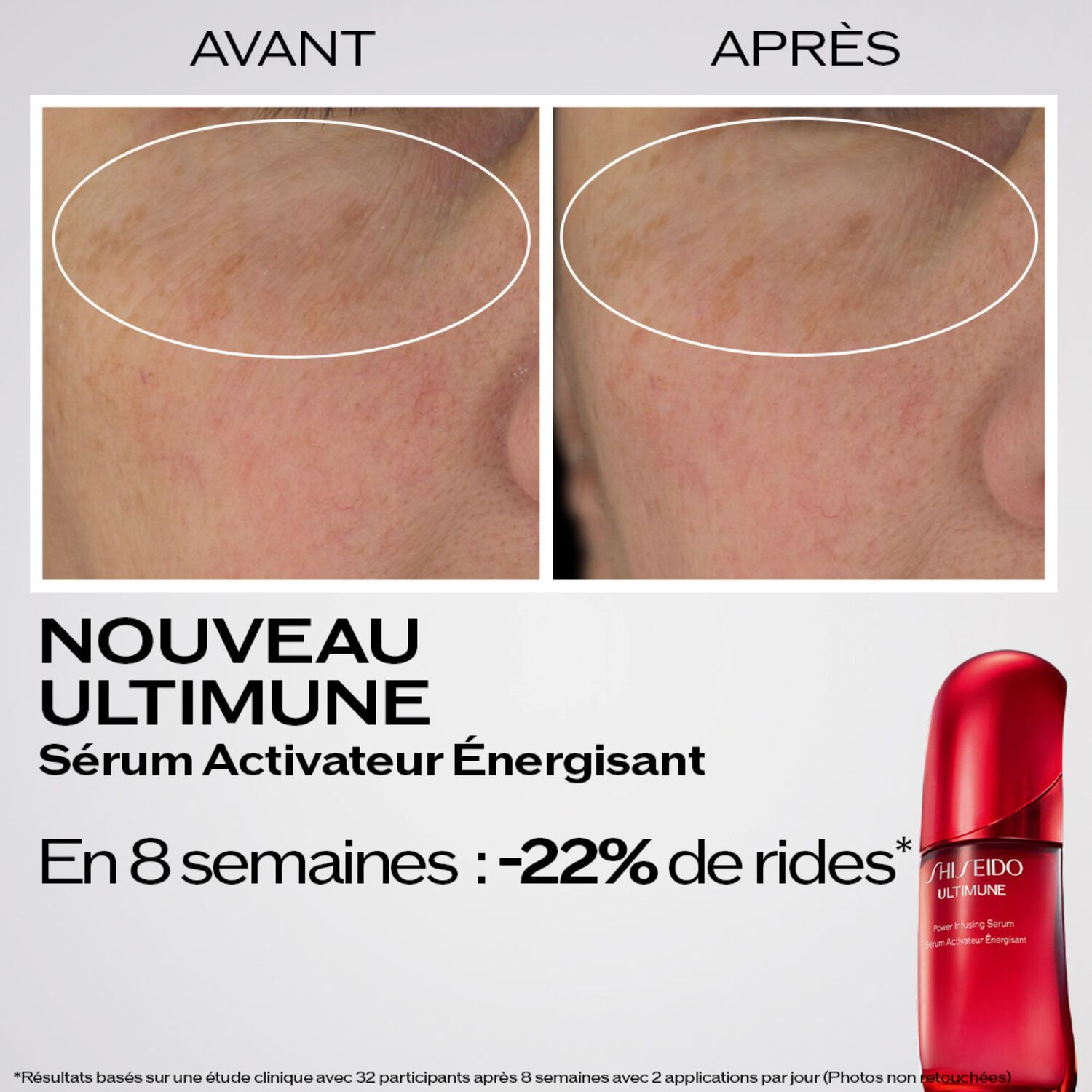 SHISEIDO Ultimune Sérum activateur énergisant 120 ml
