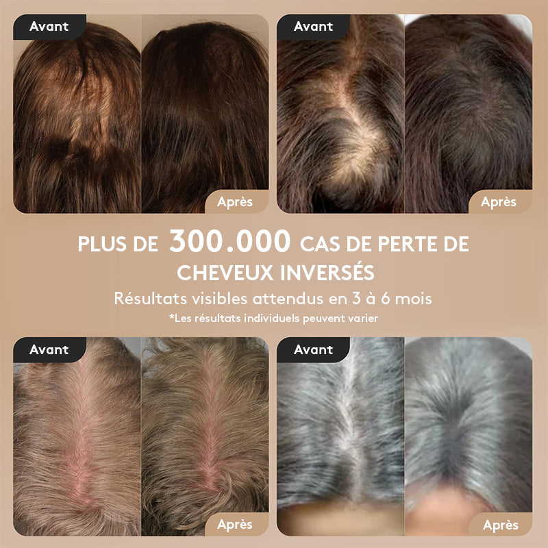 breo Scalp 3L peigne laser de repousse capillaire avec technologie infrarouge 650 nm, masseur du cuir chevelu à 360°, conception étanche, stimulation efficace du cuir chevelu et repousse des cheveux