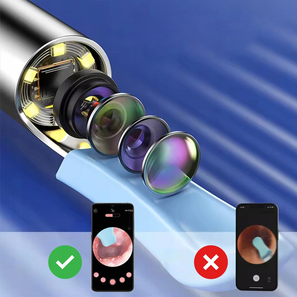Endoscope, otoscope, appareil de nettoyage des oreilles, cire, caméra WiFi SMART Zenwire Y24