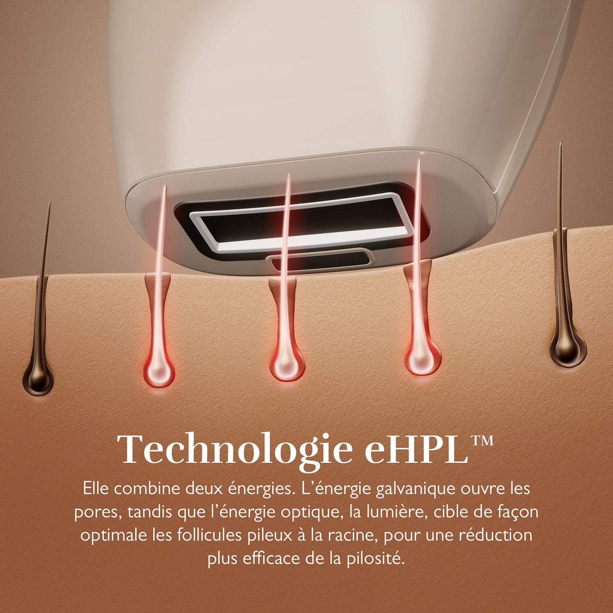 Silk N Epilateur INFF1PEUR002