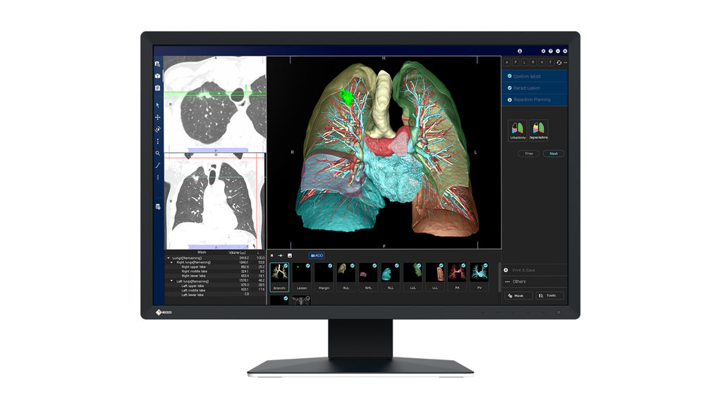 EIZO RadiForce MX243W Écran LCD 24.1" WUXGA 1920 x 1200 Noir